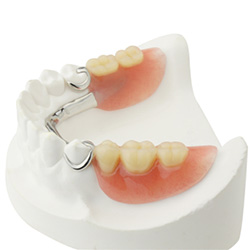 Partial dentures on smile model